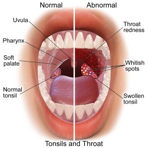 Blausen_0860_Tonsils&Throat_Anatomy_web